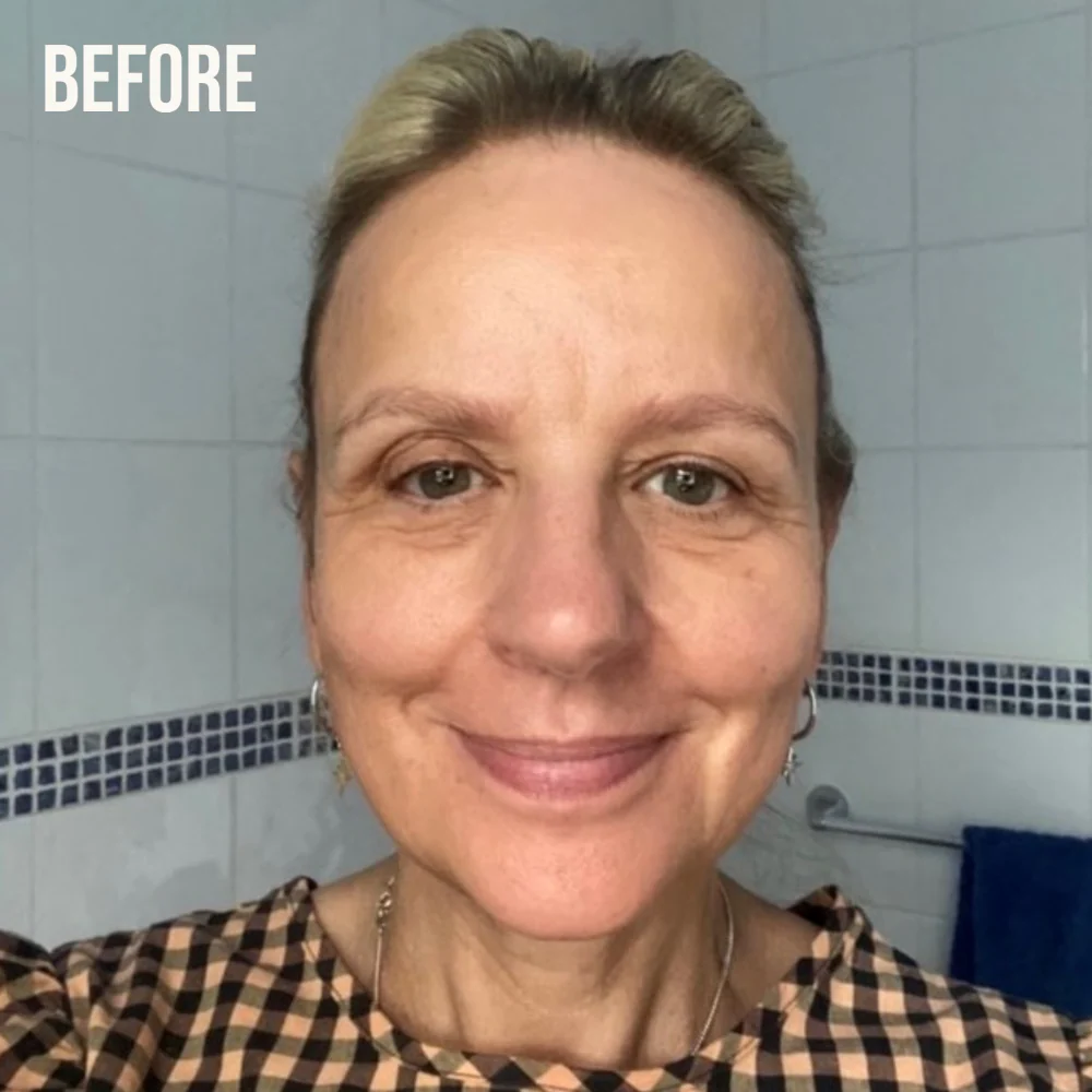Retinol Fix Fine Lines & Wrinkle Routine Kit for Skin With Signs of Ageing - Image 3
