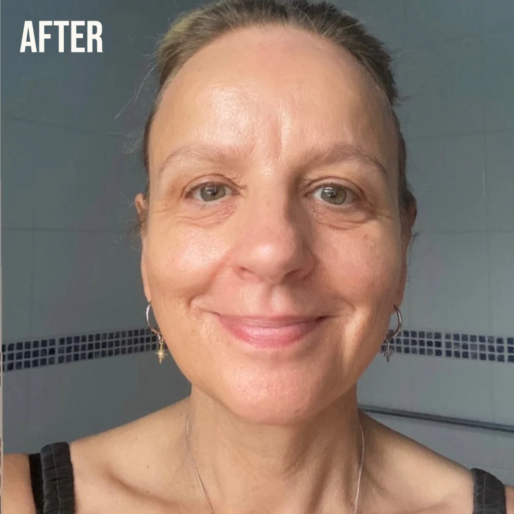 Retinol Fix Fine Lines & Wrinkle Routine Kit for Skin With Signs of Ageing - Image 4